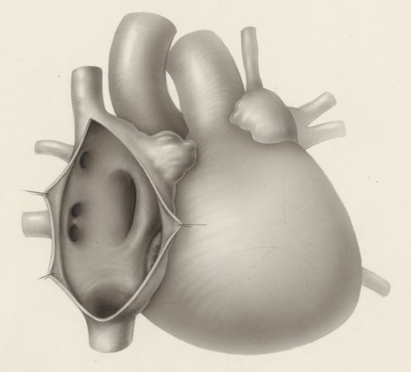 J Tinkelenberg, Thorax surgery