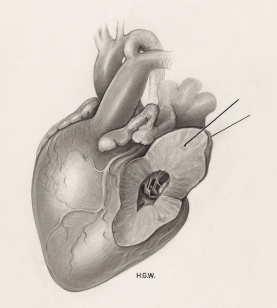 H.G Wetselaar, Heart and adjacent organs