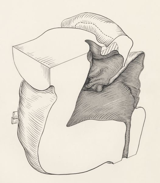 J Tinkelenberg, Reconstruction of the cerebellum