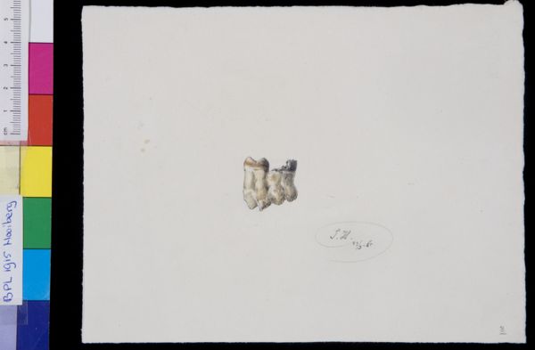 Tiemen Hooiberg, Pathology, skull, teeth