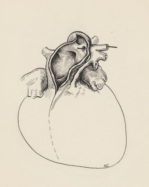 J Tinkelenberg, Cardiovascular system