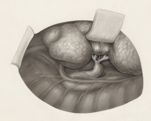 H.G Wetselaar, Human organs