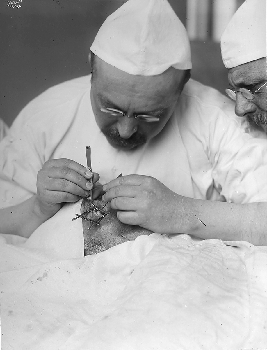 Anders Beer Wilse, Prot: Øienoperation for Dr. Holt