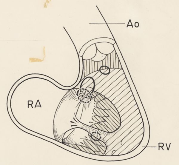 J Wetselaar-Whittaker, Schematic representation of the cardiovascular system