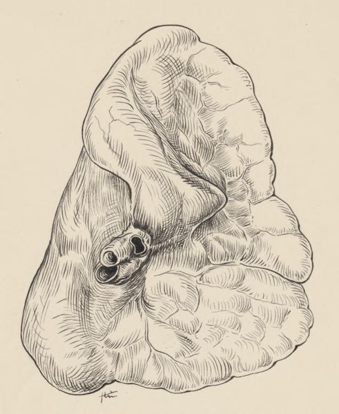 J Tinkelenberg, Part of the heart and circulatory system