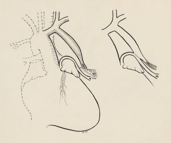 J Wetselaar-Whittaker, Circulatory system of the heart