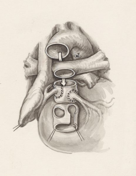 J Wetselaar-Whittaker, Cardiovascular system
