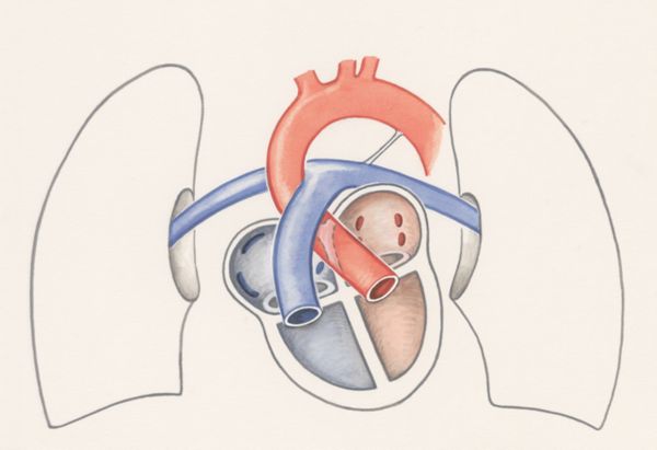 J Wetselaar-Whittaker, Arteries of the heart and adjacent organs