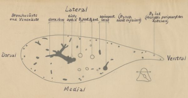 J Tinkelenberg, Cross section of the bronchi