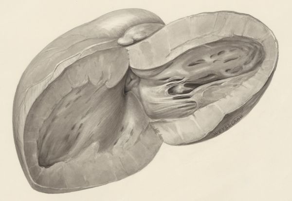 H.G Wetselaar, Heart