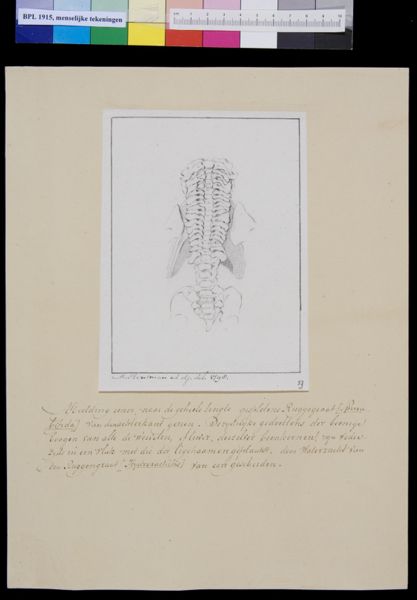 M Houtman, Spina bifida