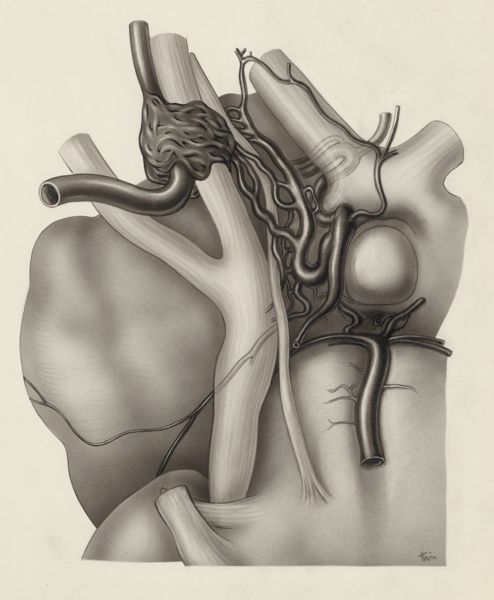 J Tinkelenberg, Circulatory system of the head