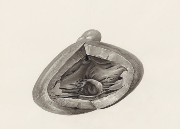 H.G Wetselaar, Cross section of a heart