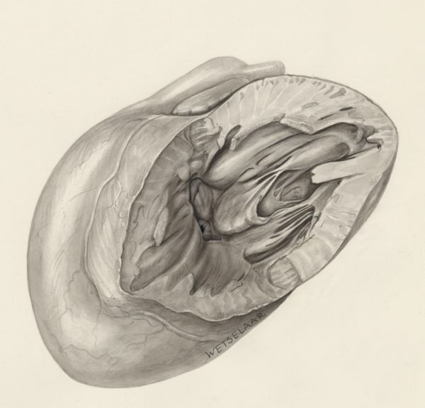 H.G Wetselaar, Heart