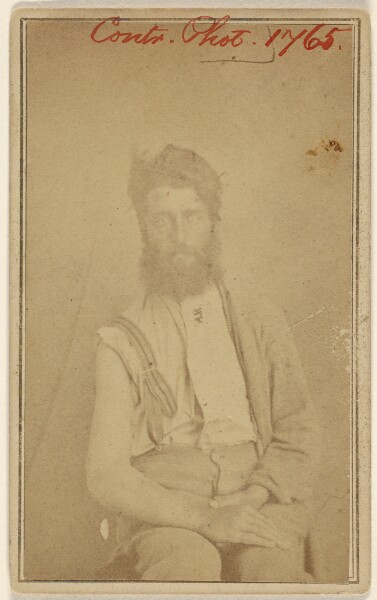 Unknown, [Unidentified Civil War victim, seated]
