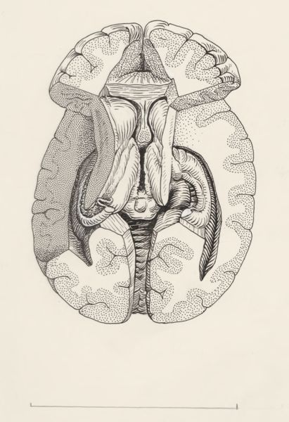 J Tinkelenberg, Human brain, seen from below
