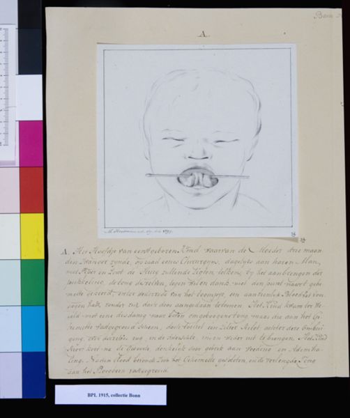 M. Houtman, Child's head with twisted tongue