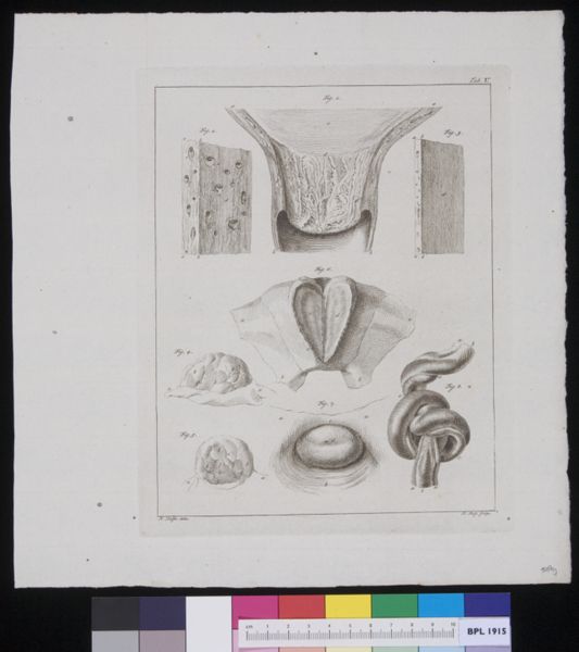 R Muys, Tissues of pregnant womb