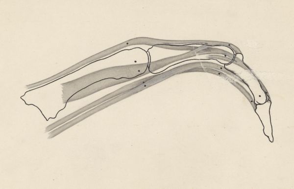 J Tinkelenberg, Schematic representation of the finger