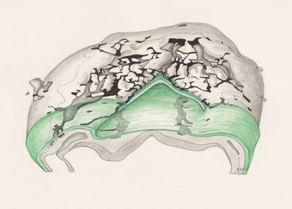 J Wetselaar-Whittaker, Four somites of a mouse