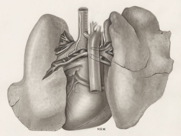 H.G Wetselaar, Heart and adjacent organs