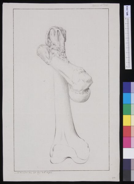 M Houtman, Femur: fracture