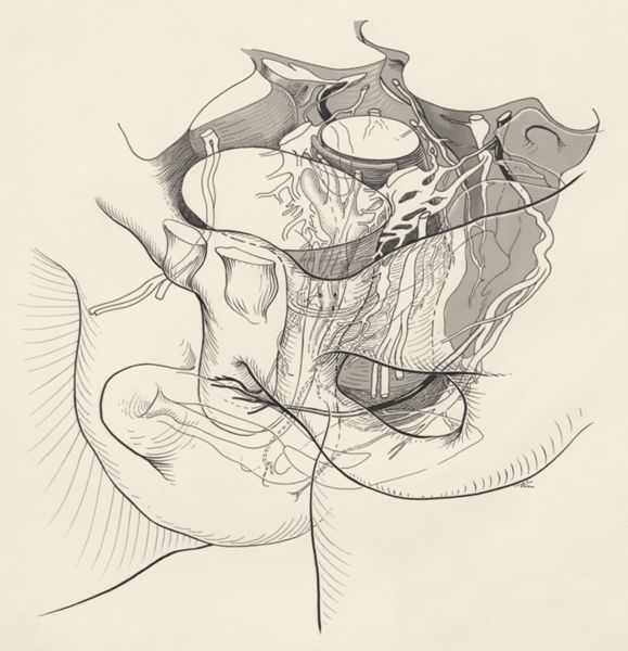 J Tinkelenberg, Urogenital system of the human embryo
