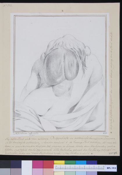 M Houtman, Deformed child