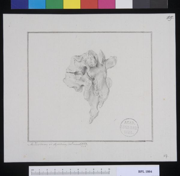 M Houtman, Pathology, fractures