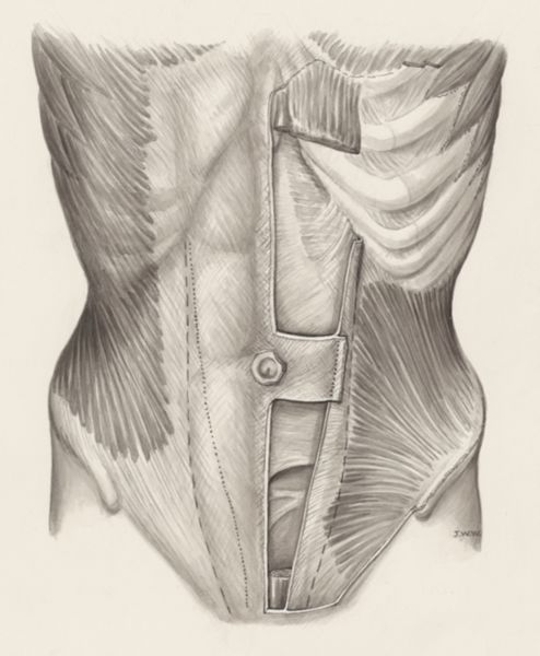 J Wetselaar-Whittaker, Muscular tissue of the abdomen