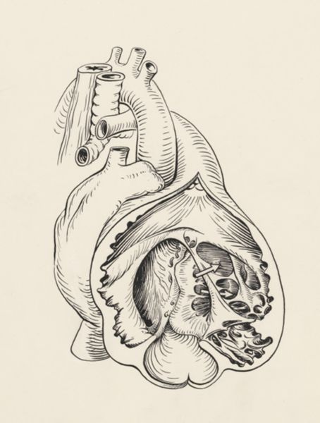 J Tinkelenberg, Part of the heart