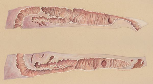 J Wetselaar-Whittaker, Lung tissue