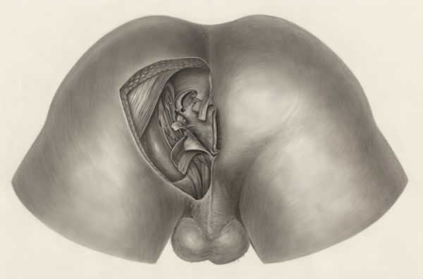 H.G Wetselaar, Tissue of the buttocks