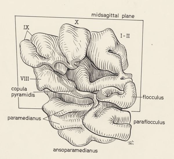 J Tinkelenberg, Cerebral tissue
