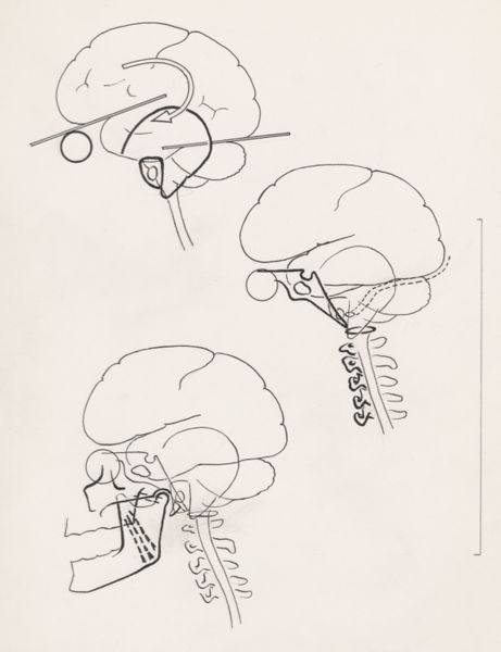J Tinkelenberg, Three schematic representations of the human brain