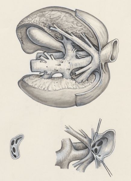 J Wetselaar-Whittaker, Respiratory system of a fetus