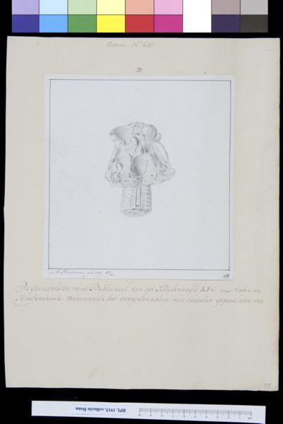 M Houtman, Skull fragment of deformed child