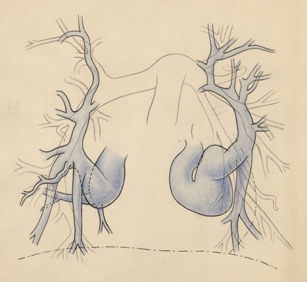 J Tinkelenberg, Circulatory system