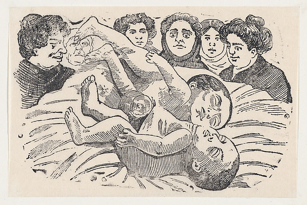 José Guadalupe Posada, Siamese Twins