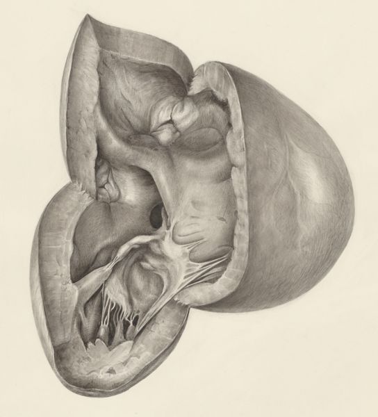 H.G Wetselaar, Heart