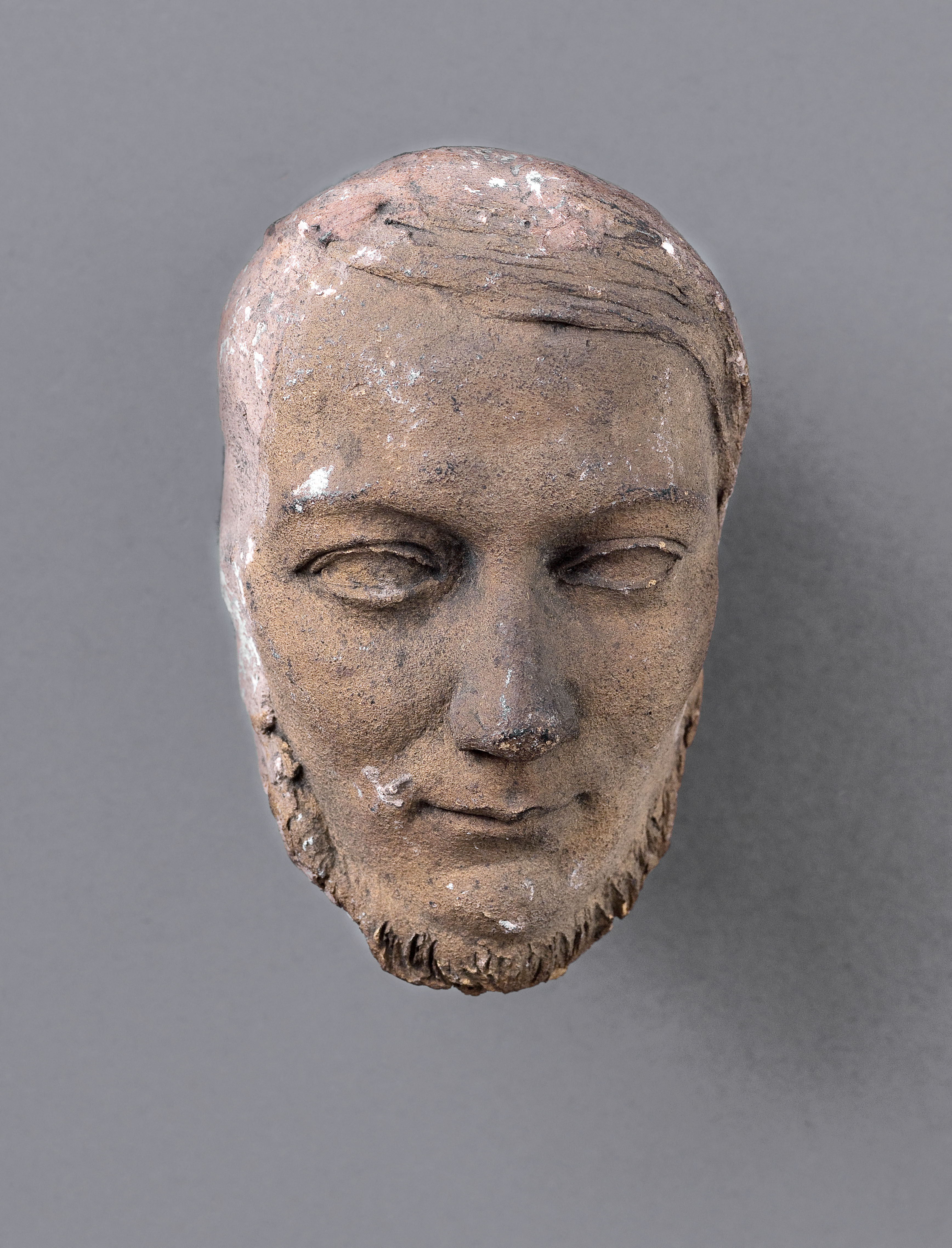 Jean Pierre Dantan, Portrait de Pierre-Louis-Alphée Cazenave (vers 1795-1877), dermatologue.