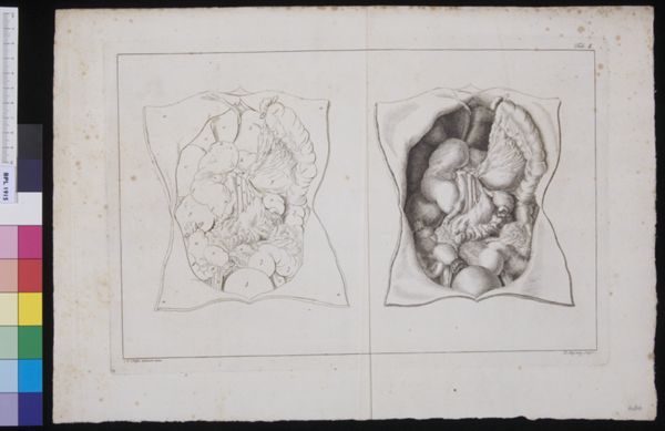 R Muys, Opened abdomen, showing the duodenum
