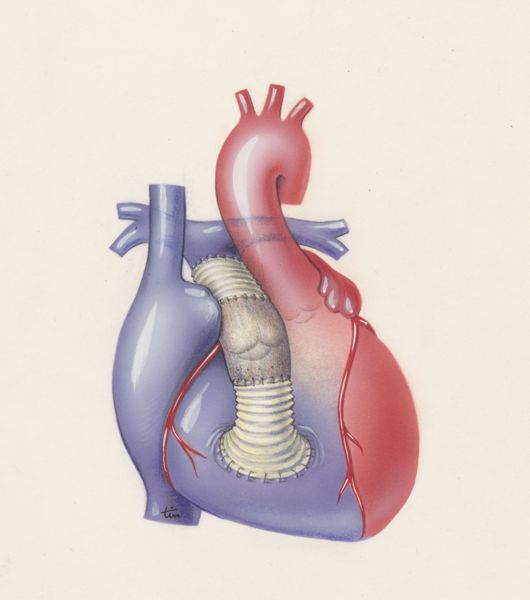 J Tinkelenberg, Thorax surgery