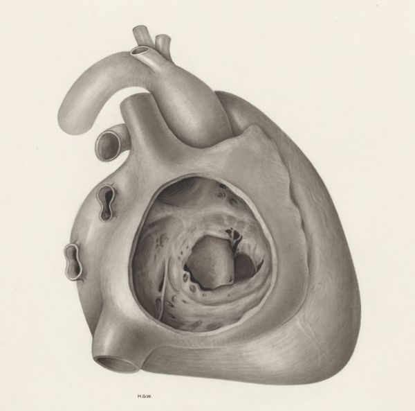 H.G Wetselaar, Heart and adjacent organs