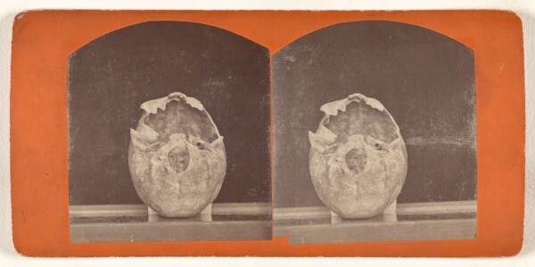 Unknown, Base View of a Cranium. From an ancient tumulus near Fort Wadsworth, Dakota Territory.