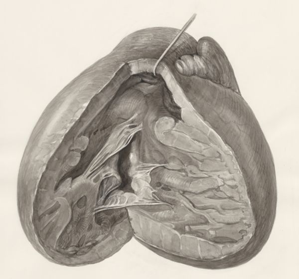 H.G Wetselaar, Heart