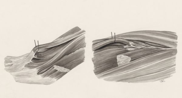 J Tinkelenberg, Muscular tissue
