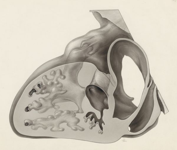 J Tinkelenberg, Embryonic heart