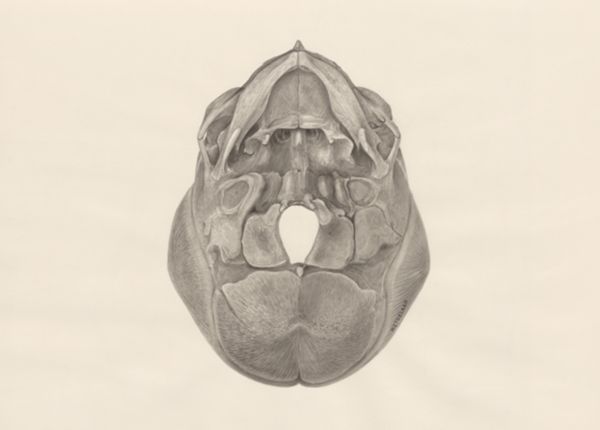 H.G Wetselaar, Deformed fetal skull, seen from below