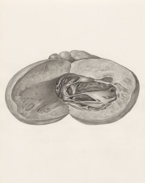 H.G Wetselaar, Heart